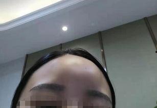 郑州整形失败爆料事件视频,揭秘美容行业潜规则与风险